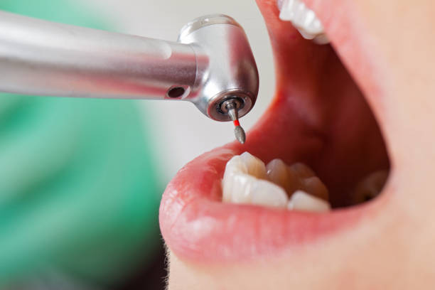 Best After-Hours Emergency Dentist in Haven, KS